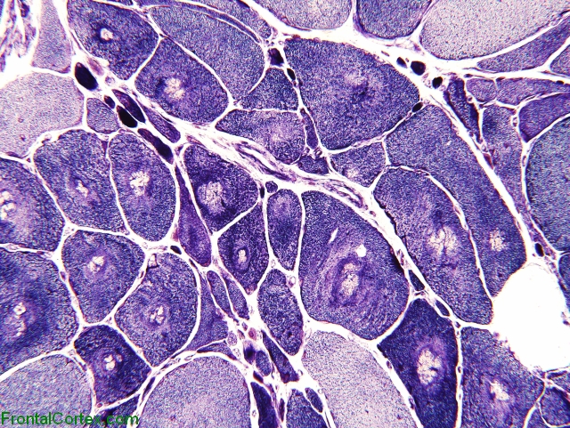 Target fibers: NADH-TR stain